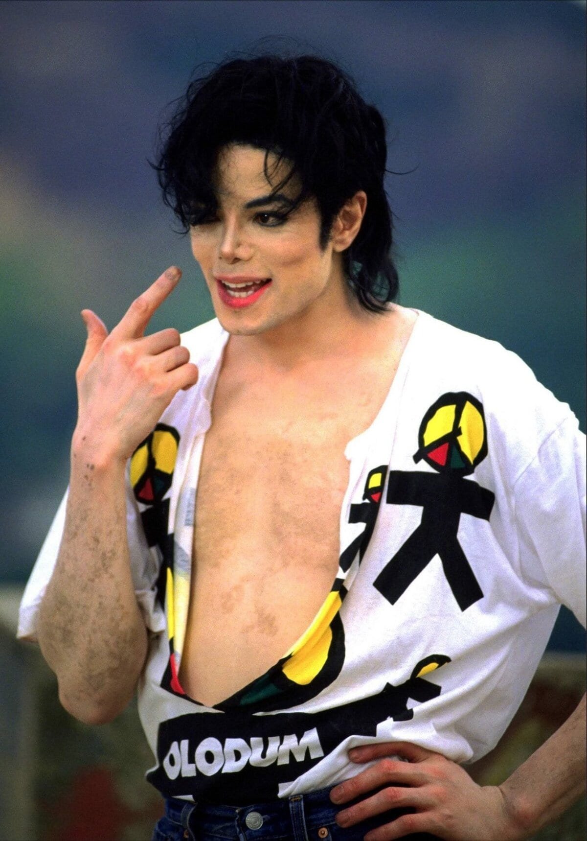 Michael-Jackson-e-o-vitiligo-MJ-Beats-1 Vitiligo: Por que o mundo escolheu ignorar a dor de Michael Jackson?