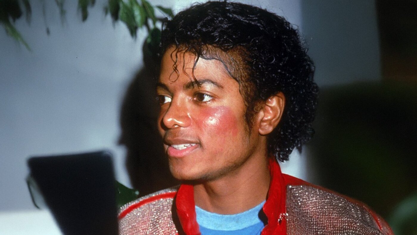Michael Jackson com manchas vermelhas possivelmente causadas por lupus nas gravações de "Beat It".